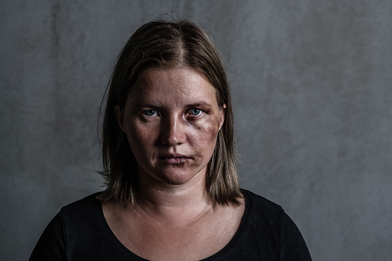 Portrait of a woman, bruised and bloodied face, victim of domestic violence and abuse