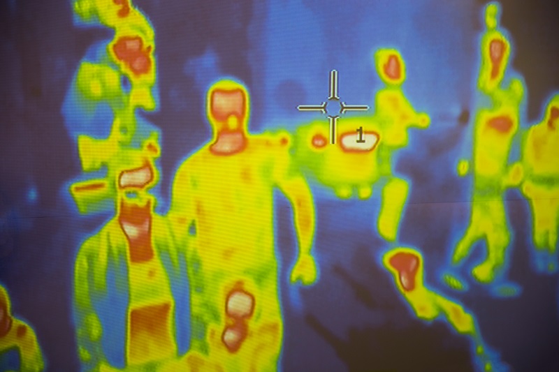 thermographic imaging