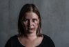 Portrait of a woman, bruised and bloodied face, victim of domestic violence and abuse